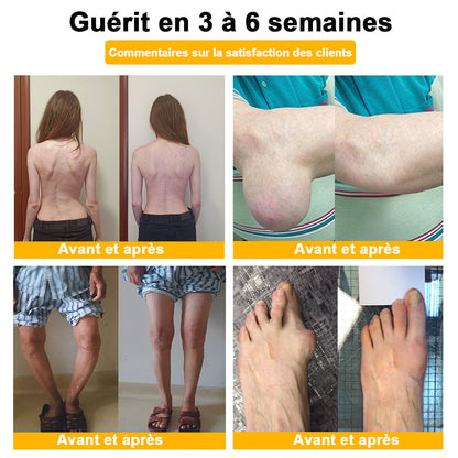 ADNOON®  Crème de guérison des os et de soulagement de la douleur au Botox et venin d'abeille