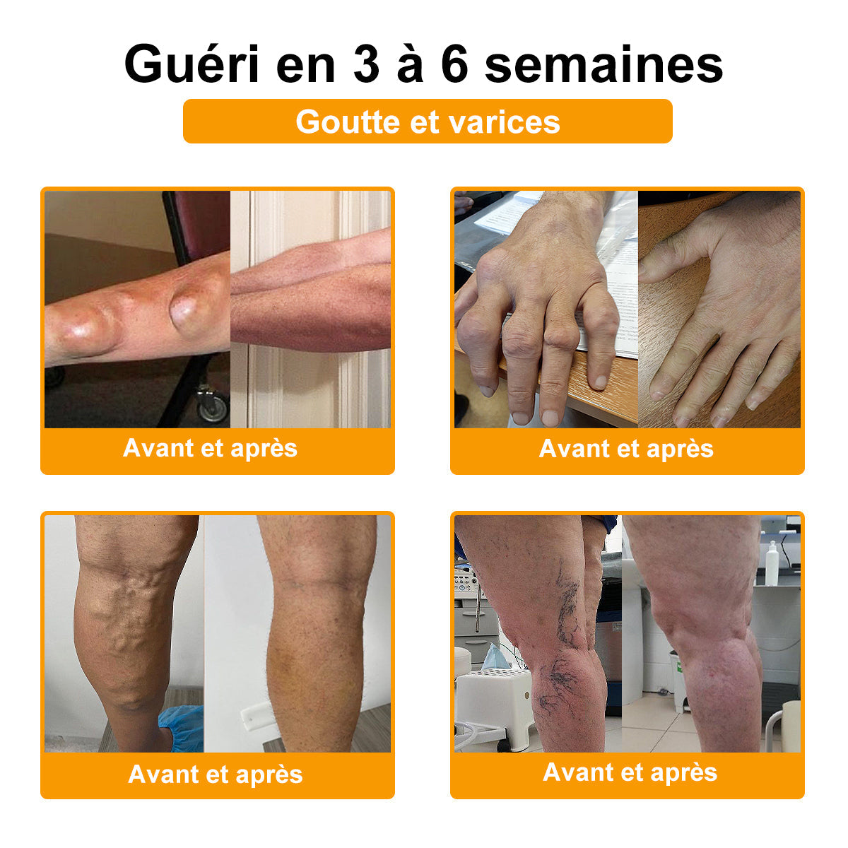 ⏰ Il ne reste plus que 10 pots d’ADNOON® en super promo ! Profitez de 30 % de rabais supplémentaires et avancez vers une vie plus saine. Après, il faudra attendre l’année prochaine !