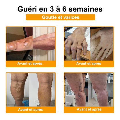 ⏰ Il ne reste plus que 10 pots d’ADNOON® en super promo ! Profitez de 30 % de rabais supplémentaires et avancez vers une vie plus saine. Après, il faudra attendre l’année prochaine !