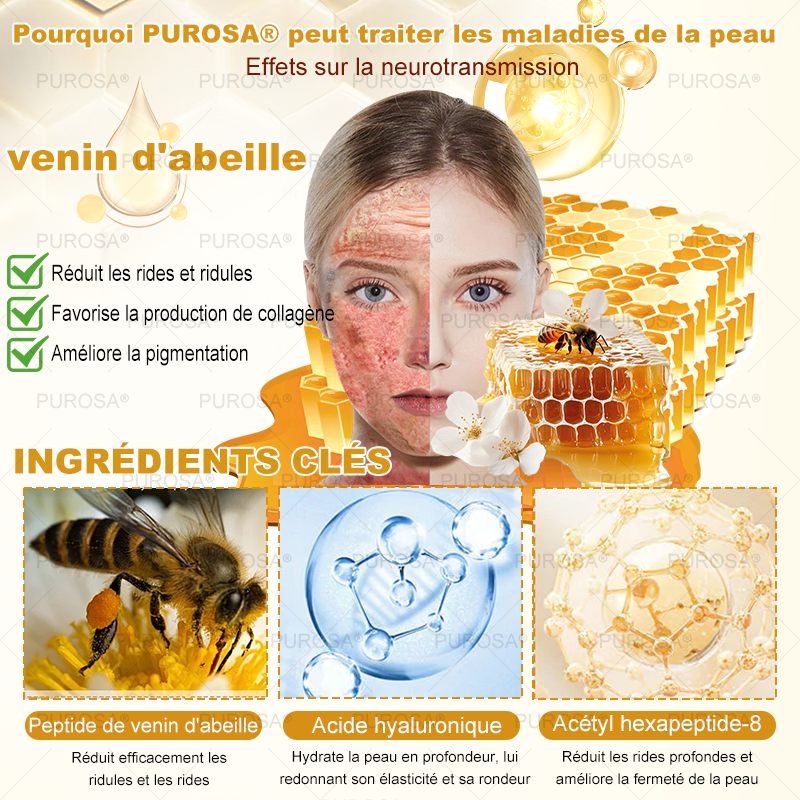 Limité à 10 pots seulement !🌟PUROSA®—Rabais exclusif de 30 %,retrouvez l’éclat jeunesse de votre peau en seulement 1 à 3 semaines!Une offre rare—elle ne reviendra pas avant l’an prochain,ne la manquez pas!💰Garantie de remboursement de 180 jours