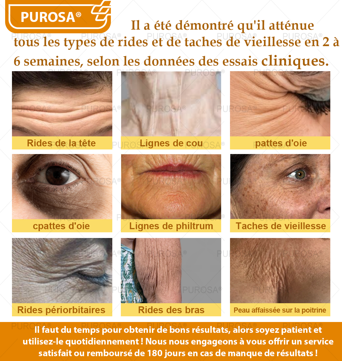 Limité à 10 pots seulement !🌟PUROSA®—Rabais exclusif de 30 %,retrouvez l’éclat jeunesse de votre peau en seulement 1 à 3 semaines!Une offre rare—elle ne reviendra pas avant l’an prochain,ne la manquez pas!💰Garantie de remboursement de 180 jours