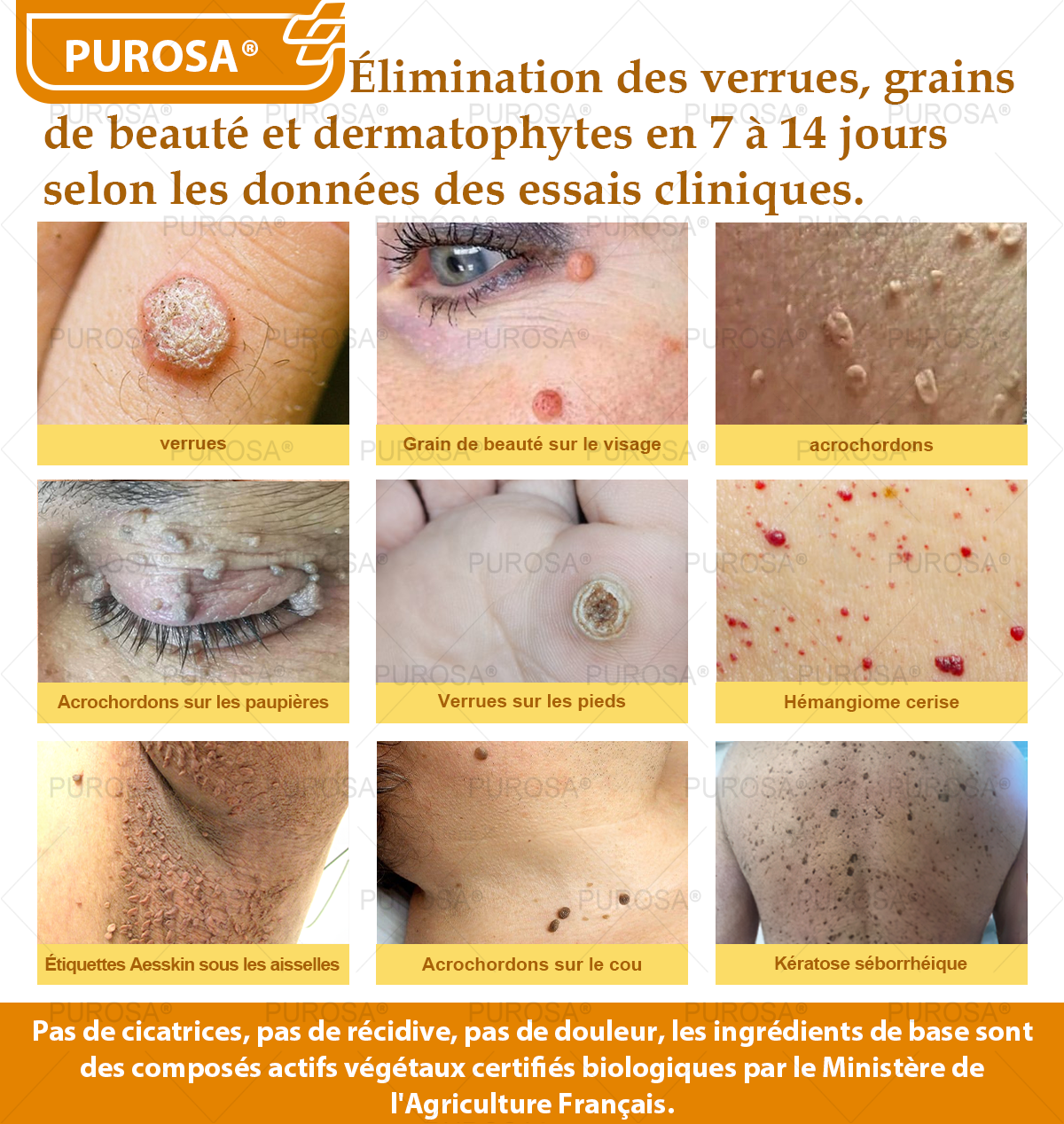 Limité à 10 pots seulement !🌟PUROSA®—Rabais exclusif de 30 %,retrouvez l’éclat jeunesse de votre peau en seulement 1 à 3 semaines!Une offre rare—elle ne reviendra pas avant l’an prochain,ne la manquez pas!💰Garantie de remboursement de 180 jours