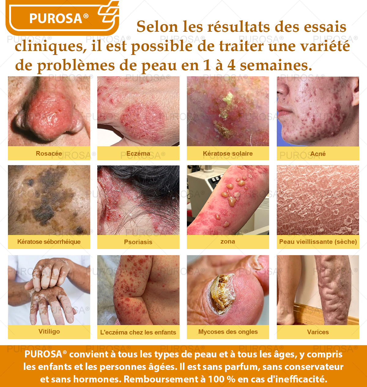 Limité à 10 pots seulement !🌟PUROSA®—Rabais exclusif de 30 %,retrouvez l’éclat jeunesse de votre peau en seulement 1 à 3 semaines!Une offre rare—elle ne reviendra pas avant l’an prochain,ne la manquez pas!💰Garantie de remboursement de 180 jours